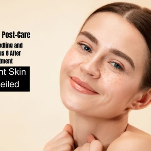 Radiant Skin Unveiled: A Guide to Post-Care Microneedling and Morpheus 8 After Treatment