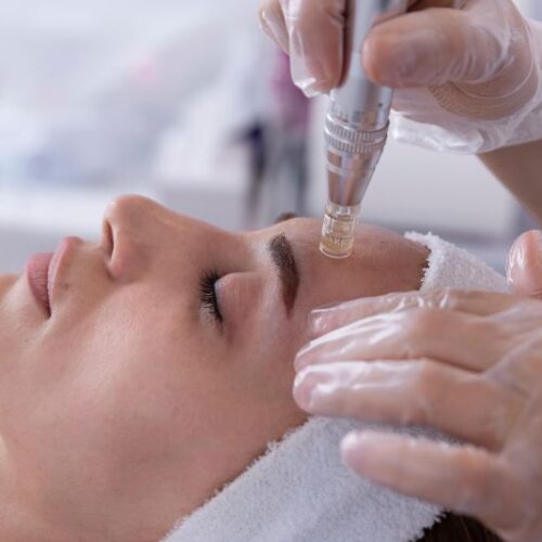 Discover the Latest Beauty Treatments at Med Spas: Why Micro-Needling is a Must-Try