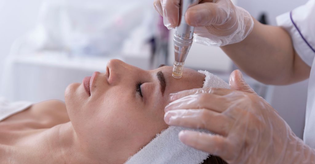 Discover the Latest Beauty Treatments at Med Spas: Why Micro-Needling is a Must-Try