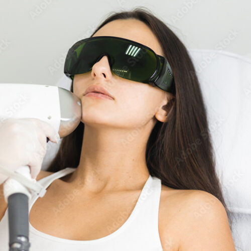 The Luminous Glow: Unpacking the Benefits of Facial Laser Treatments