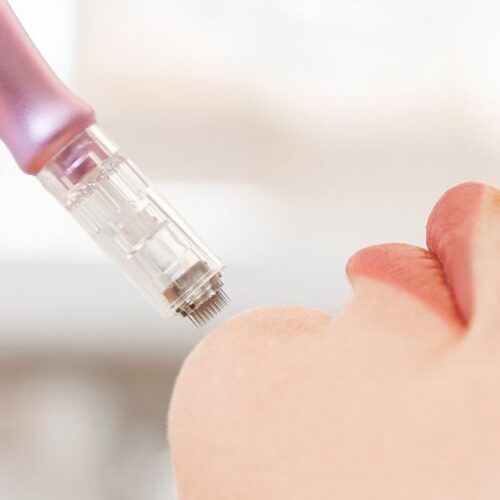 Why Estheticians and Doctors Are Raving About Micro-Needling: A Deep Dive into Its Benefits