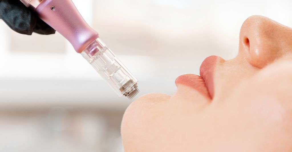 Why Estheticians and Doctors Are Raving About Micro-Needling: A Deep Dive into Its Benefits